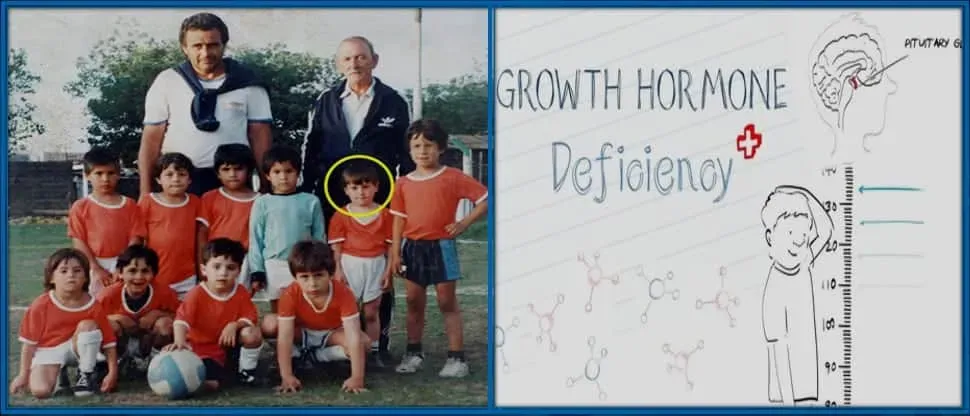 La enfermedad por deficiencia de la hormona del crecimiento hizo que Lionel pareciera m&aacute;s peque&ntilde;o que sus compa&ntilde;eros.
