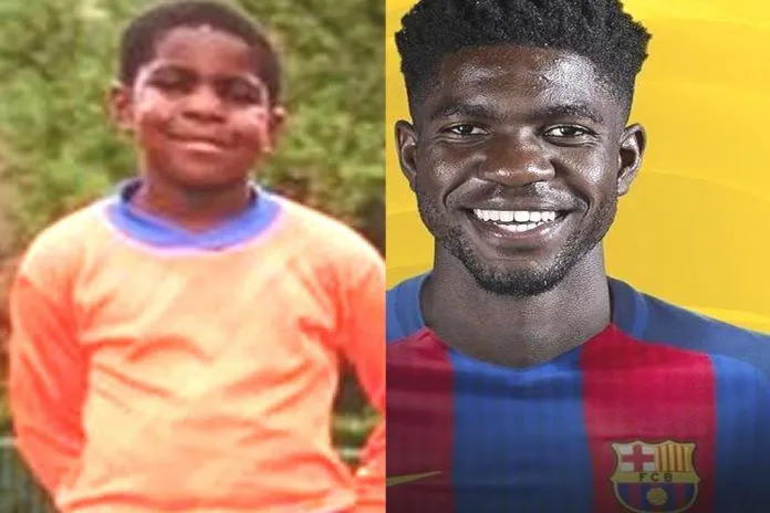 Samuel Umtiti Childhood Story Plus Untold Biography Facts