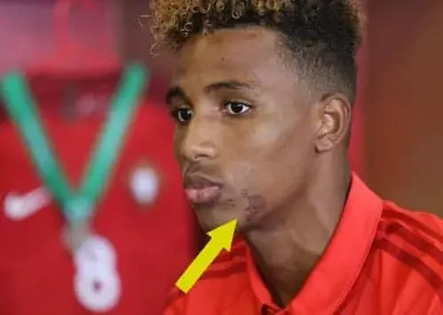 Gedson Fernandes Scar on Face- What does this mean?. Credit: Instagram.