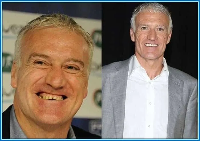 Didier Deschamps Childhood Story Plus Untold Biography Facts