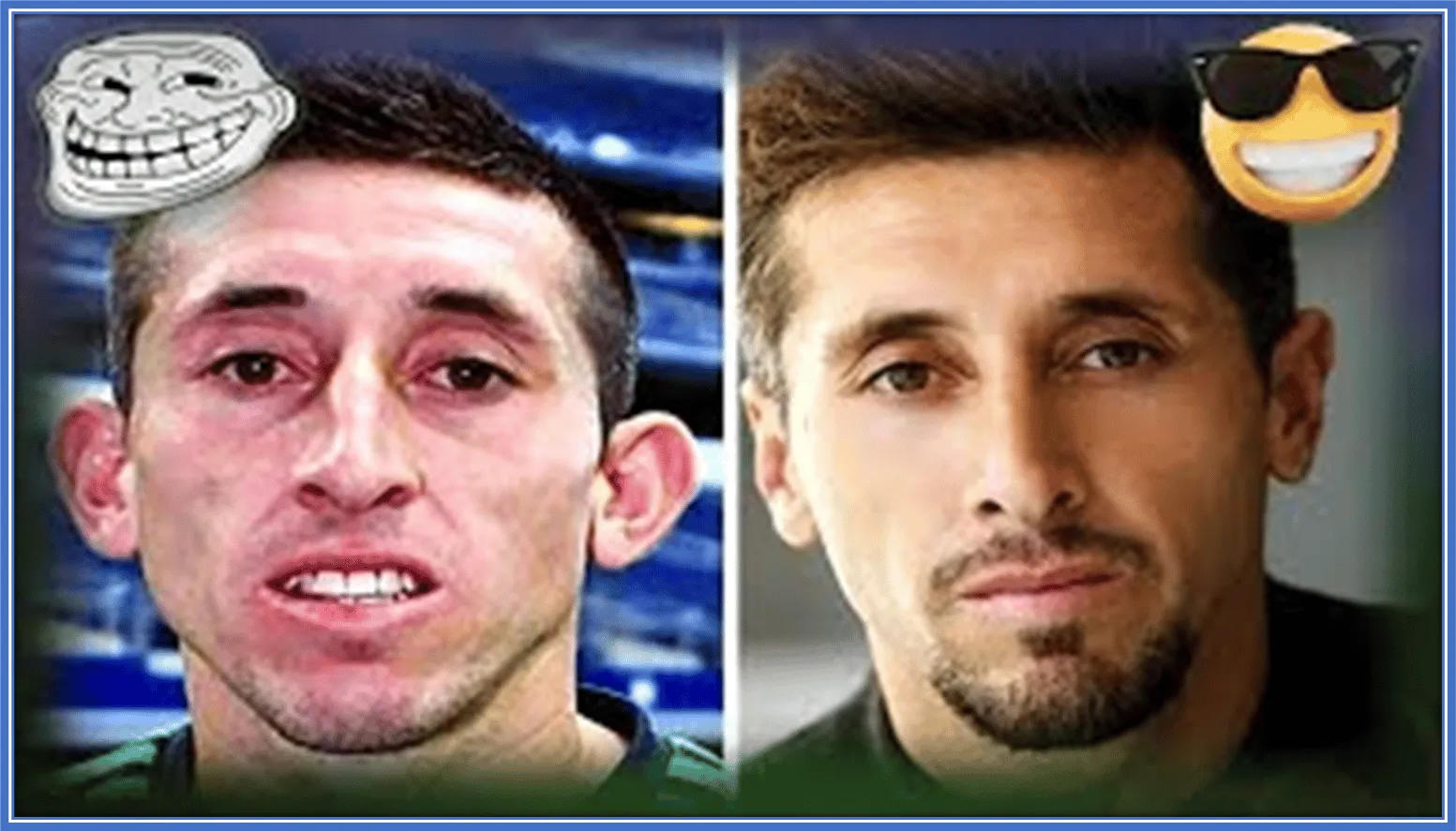A collage of his former face and then his new appearance.
