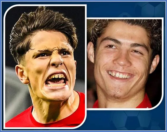 He joined Man United because of CR7, does the CR7 celebration and has decided to keep his teeth this way.