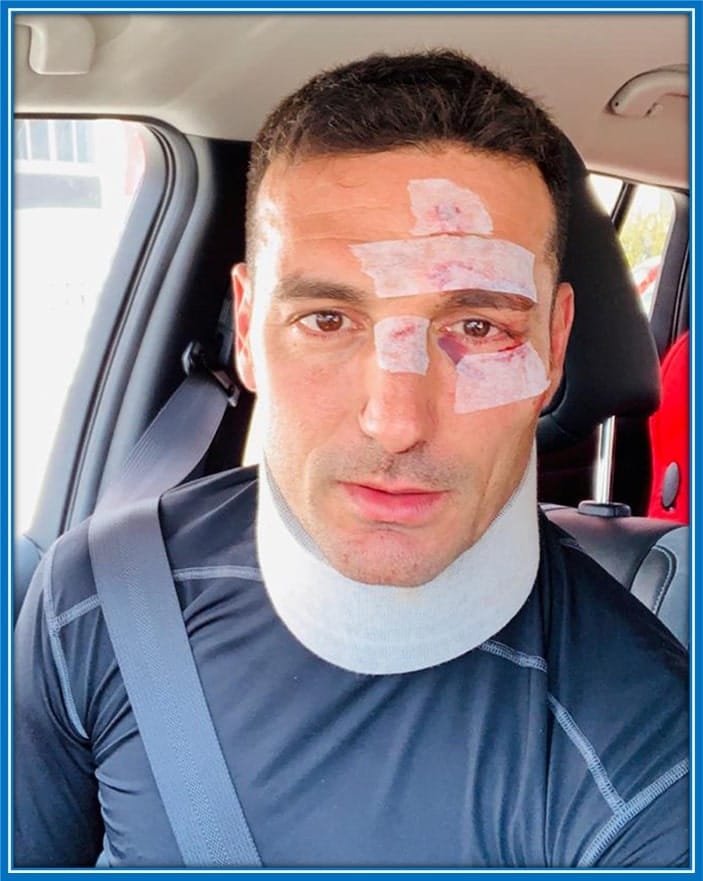 The former West Ham star after being discharged from the hospital following a traffic accident.