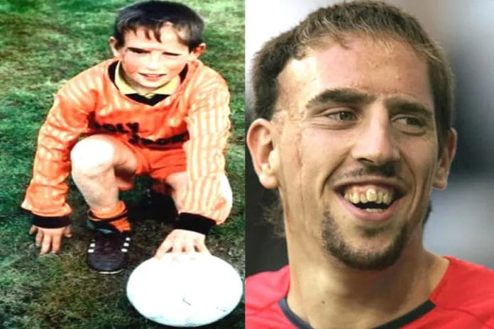Franck Ribery Childhood Story Plus Untold Biography Facts