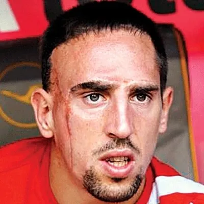 The story behind Franck Ribery's Scar Face.