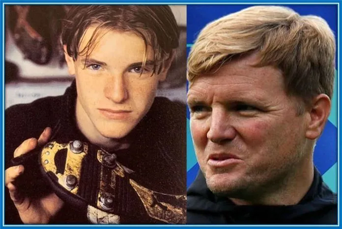 Eddie Howe Childhood Story Plus Untold Biography Facts